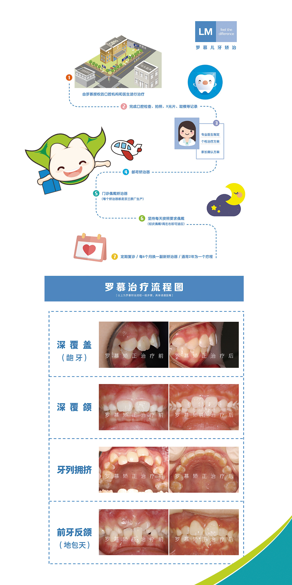 罗慕咬合诱导(lm-dental)技术